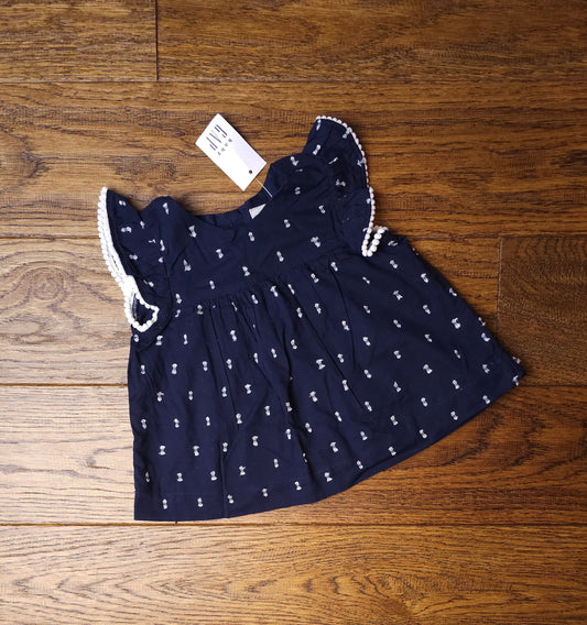 GAP Tunic Top 3-6 Months